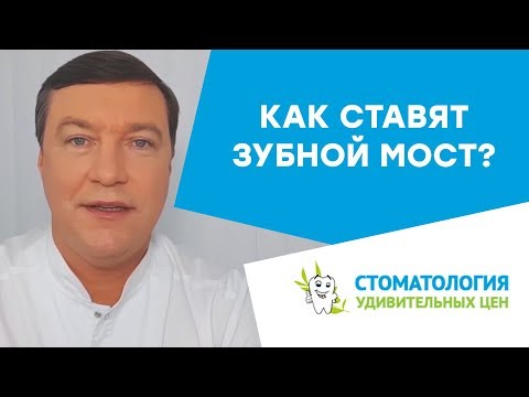 Как ставят зубной мост? Мост на задние и передние зубы.