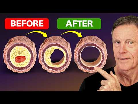 How to Reverse Plaque — 20 Years of Knowledge in One Video