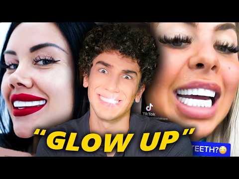 The Veneer Epidemic Nobody’s Talking About