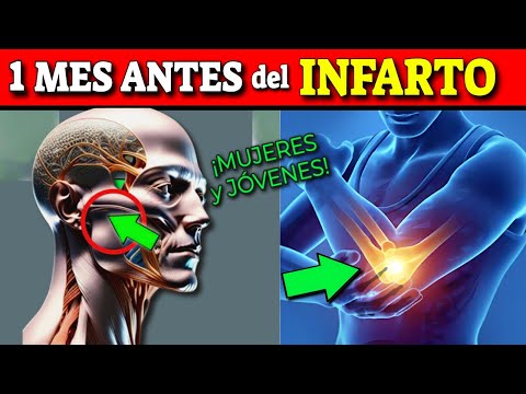 SEÑALES 1 MES ANTES de que TE INFARTES| ATAQUE al CORAZÓN