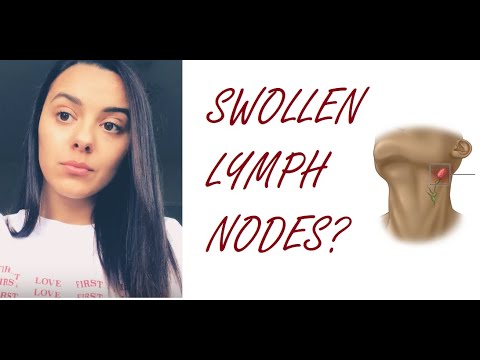 Swollen Lymph Nodes? Don’t Panic!