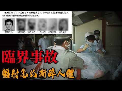 25年前日本東海村發生核事故，受害者家屬強烈要求下，治療過程得以全公開，大家這才知道強輻射怎麼把一個健康成年人粉碎掉