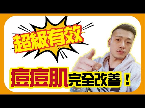 對抗青春痘大作戰 ！還我漂漂拳 ！！【77老大】