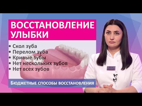 Восстановление зубов: как не переплатить? виниры, вкладка, зубная коронка, зубной имплант, all-on-4