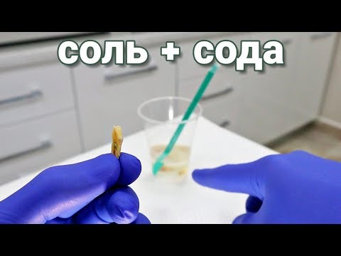 Perfect Teeth. Salt + Soda