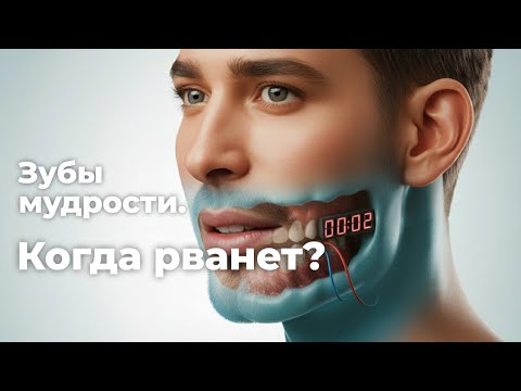 ​👨‍⚕️​ Нужно ли удалять зубы мудрости, если они не беспокоят?