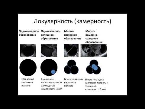 Современные подходы к классификации опухолей малого таза у женщин в ультразвуковой диагностике