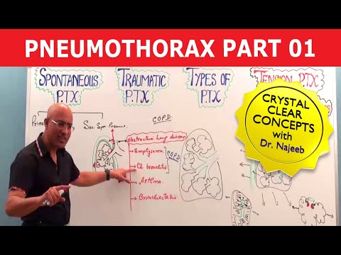 Pneumothorax | Basic Pathology | Part 1🩺