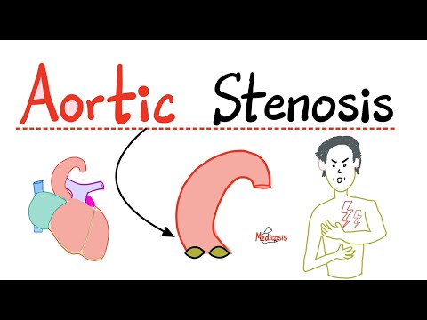 Aortic Stenosis (AS) - Valvular Heart Disease (VHD) - Causes, Symptoms, Diagnosis, Treatment -Cardio
