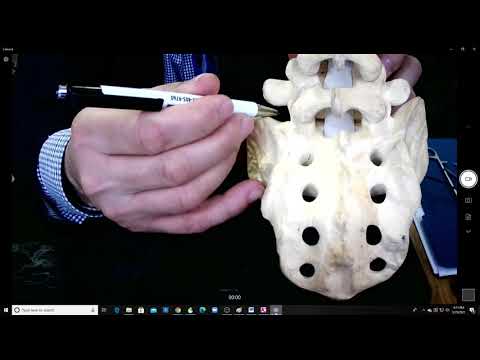 S1 pedicle screw placement tips and tricks EXTENDED