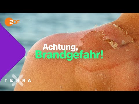 Das passiert beim Sonnenbrand  | Terra X plus