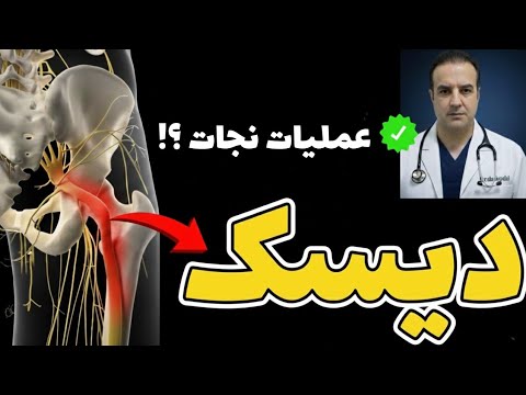 درمان قطعی و تضمینی دیسک کمر و سیاتیک (بدون جراحی و دارو) / فیزیوتراپی دیسک کمر در خانه