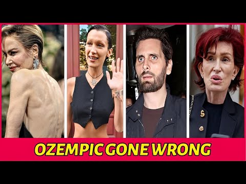 19 Celebs With Ozempic Face Before and After Photos | You’d Never Recognize Today