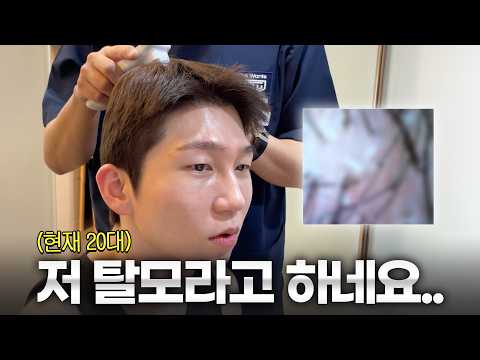 Men in their 20s with thinning hair, go to the hospital immediately. Here's a look at Tibetan Bro...