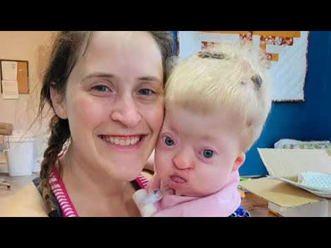 Girl Has Condition Only About 100 People in The World Have