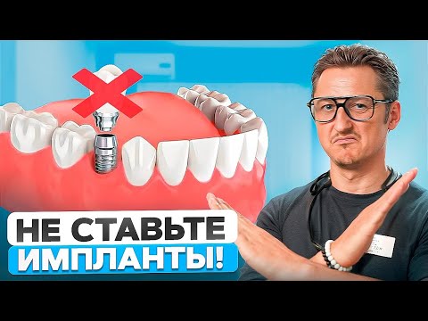 Кому НЕЛЬЗЯ ставить импланты? Стоматологи молчат об этом!