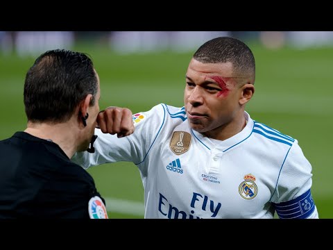 1 in 1.000.000 Moments in Football