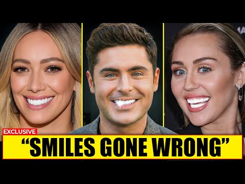 15 Celebrities Who RUINED Their Smiles With Veneers