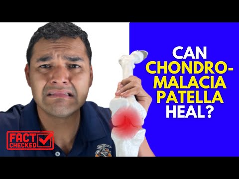 Does Knee Pain Ever Really Feel Better Once You Have Chondromalacia Patella?