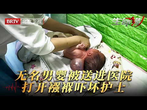 17天无名男婴被好心人送进医院，打开襁褓一刹那，护士被眼前的肿物吓坏了……【生命缘第13季】
