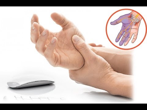 Синдром карпального канала - причины, последствия и лечение