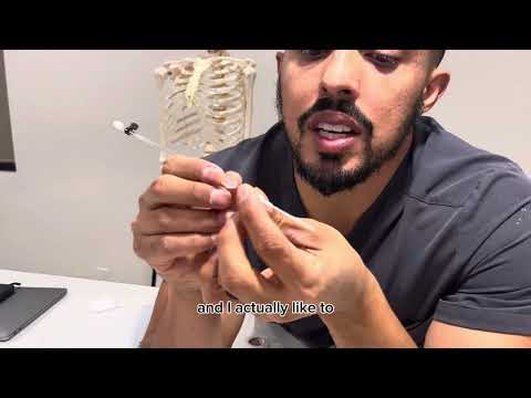 Arterial line placement: radial a-line tips and tricks. Anesthesia OR a line