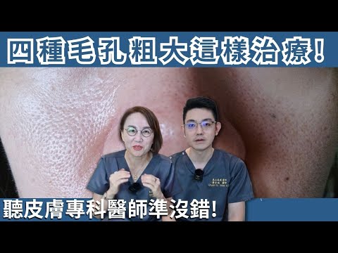 當心毛孔粗大像橘皮！毛孔粗大四類型！醫美治療與保養品改善你適合哪一種？