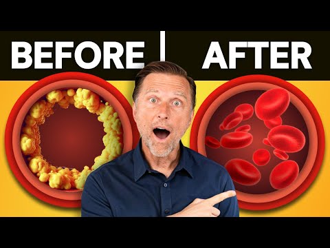 #1 BEST Meal to Prevent a Heart Attack and Stroke