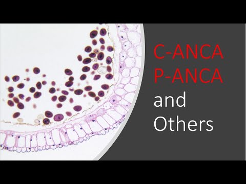c-ANCA and p-ANCA  +  Other Antibodies Explained