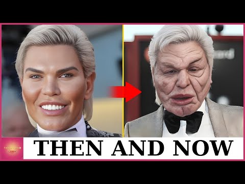 10 Famous Celebrities Who Took Plastic Surgery Too Far | Then and Now 2026