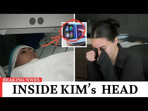 Kim Kardashian MRI Shock: Terrifying Brain Discovery Exposed