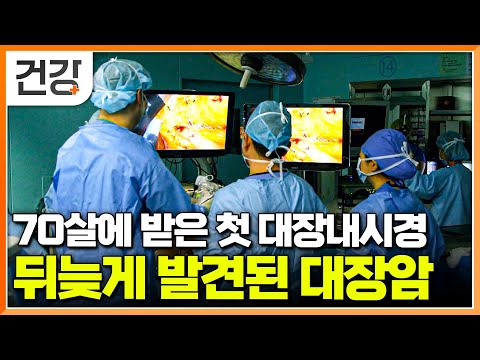 "별다른 증상 없어서 미루고 미뤘더니" 대장내시경 검사를 정기적으로 받아야 하는 이유│대장암 환자들에게 공통으로 발견된 초기 증상│대장암 수술 과정│명의│#EBS건강