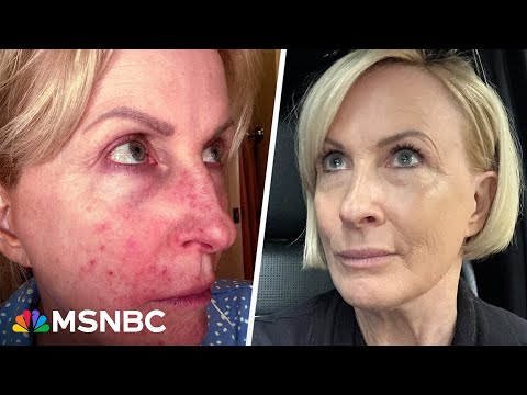 'I looked grotesque': Mika shares ugly truth about products that made her sick