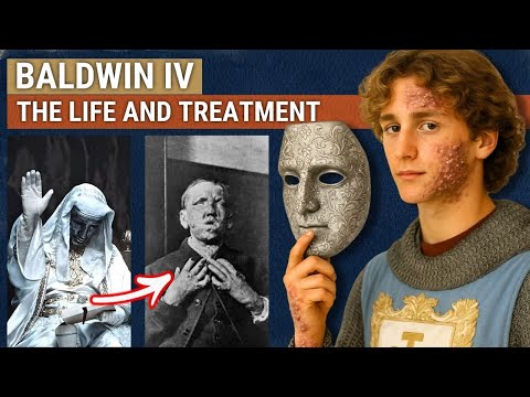 Leprosy and the King: Baldwin IV vs Saladin
