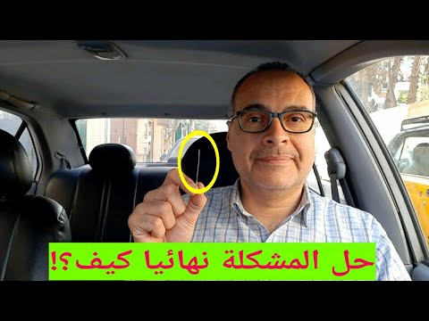 مشكلة حساس الشكمان حساس العادم