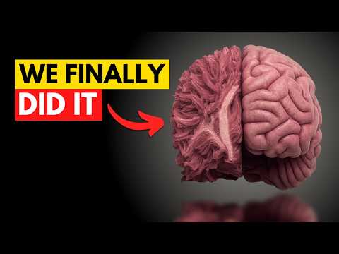 We FINALLY Broke Huntington’s Curse - Breakthrough Explained