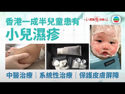 TVB最強生命線|小兒濕疹 (繁 / 簡字幕)|醫療|治療||無綫新聞|TVB News