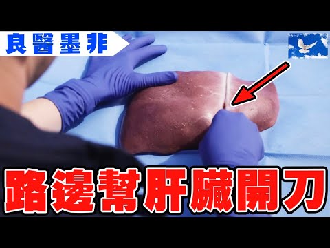 天才醫生拯救活體肝臟 肝衰竭患者大吐血 | 良醫墨非/天才肖恩S1EP3 | 蒼藍鴿評評理EP71