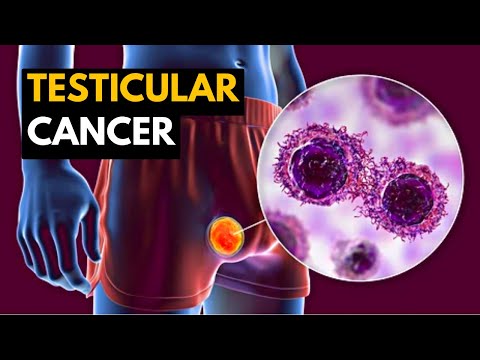 Testicular Cancer, Causes, Signs and Symptoms, Diagnosis and Treatment.