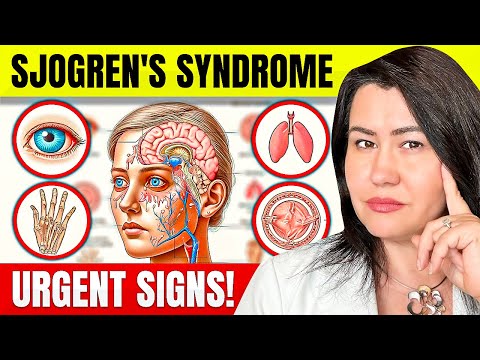 10 URGENT SIGNS of SJOGREN'S DISEASE: Rheumatologist Explains