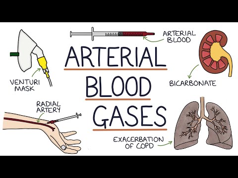 Understanding Arterial Blood Gases