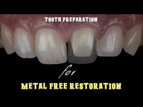 Anterior Tooth Preparation for Metal Free Restoration... Video Demonstration