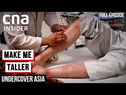 The Extreme Lengths To Grow Taller: Limb-Lengthening Surgery In India | Undercover Asia
