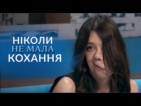 ЇЇ бояться навіть ДІТИ! Чому в очах людей вона виглядає МОНСТРОМ? "Говорить Україна". Архів