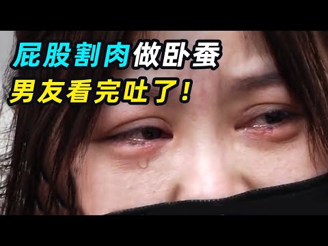 一口气看完6个奇葩整容，美女用臀部组织做卧蚕翻车，男友：分手吧！
