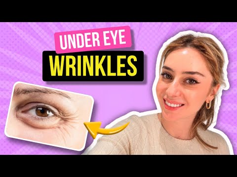 How to Treat Under Eye Wrinkles from a Dermatologist! | Dr. Shereene Idriss