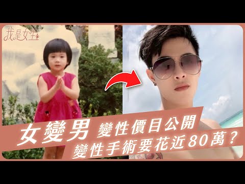 【愛里】女變男變性價目表公開！變性手術要花近80萬？