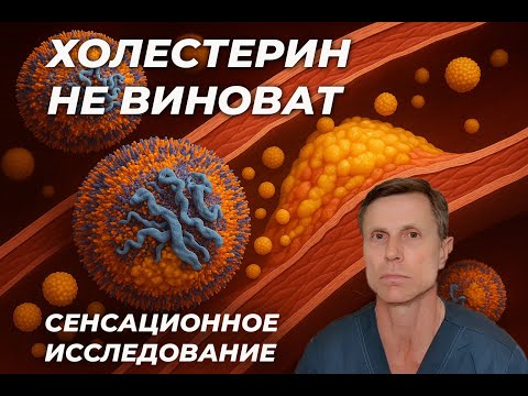 Сенсационное исследование : бляшки в сосудах не связаны с высоким холестерином. Революция в науке!