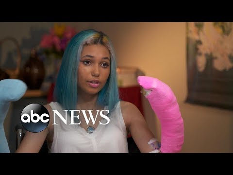 Teen recalls terrifying shark attack