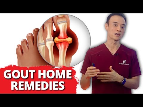 (Relief Fast) 6 Home Remedies For Gout!